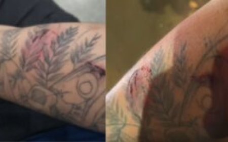 Motorista de aplicativo é mordido por passageira durante discussão em Dourados