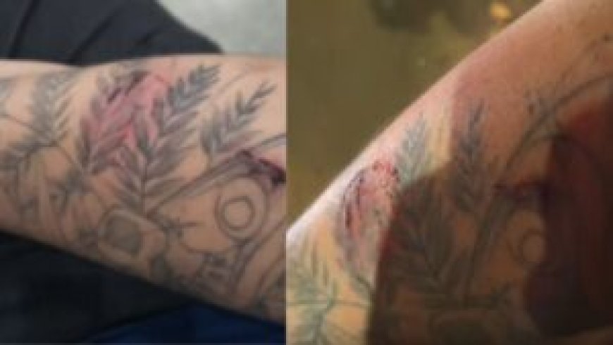 Motorista de aplicativo é mordido por passageira durante discussão em Dourados