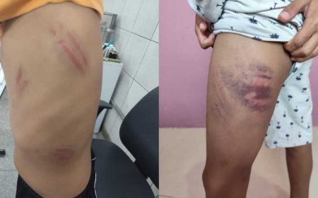 Menino Autista É Surrado Dentro e Fora da Escola em Campo Grande