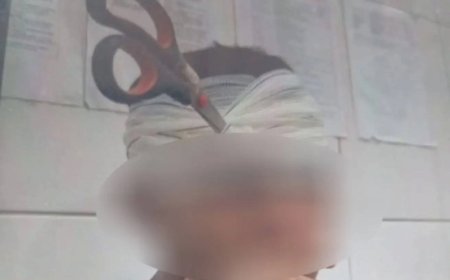 Brincadeira de Casal Termina em Tragédia com Tesoura Cravada