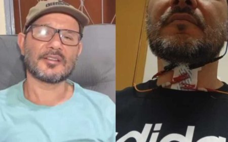 Fagner: Doença Rara e Degenerativa Muda Vida de Homem
