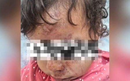 Bebê morta após atropelamento teve alta médica sem condições de alta