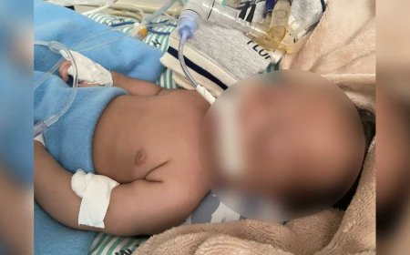 Bebê de 1 mês em estado grave: tia apela por vaga em CTI em Campo Grande
