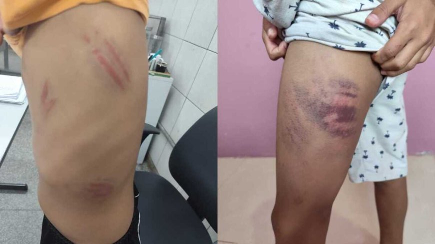 Menino Autista É Surrado Dentro e Fora da Escola em Campo Grande