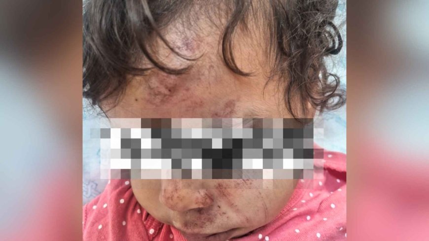Bebê morta após atropelamento teve alta médica sem condições de alta