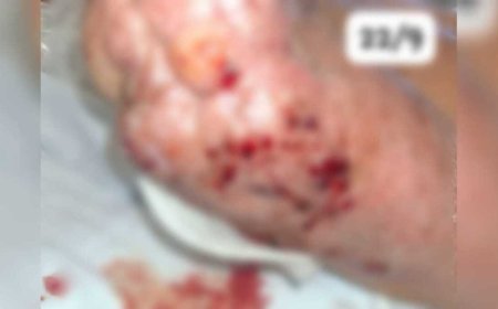 Idoso processa hospital por lesão grave em Água Clara