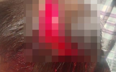 Justiça Mantém Prisão de Mãe Acusada de Agredir Filho de 2 Anos