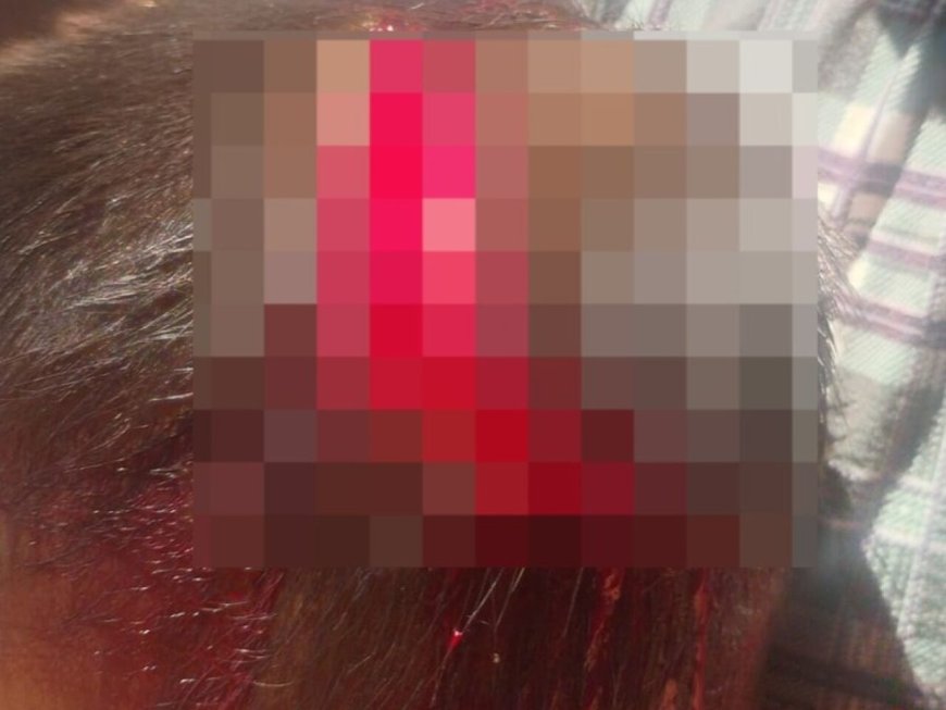 Justiça Mantém Prisão de Mãe Acusada de Agredir Filho de 2 Anos