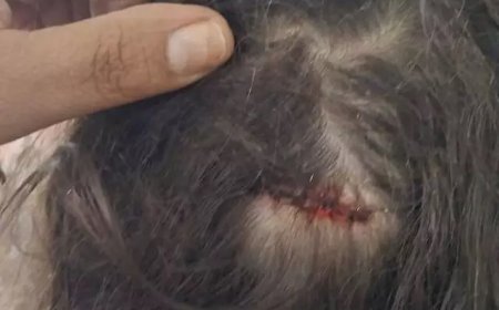 Menina de 7 anos é ferida por bala perdida enquanto dormia em casa em Campo Grande