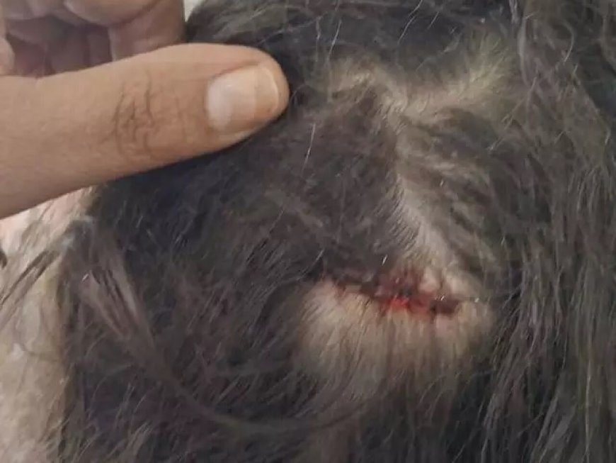 Menina de 7 anos é ferida por bala perdida enquanto dormia em casa em Campo Grande