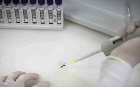 Exames descartam ebola em imigrante da República Democrática do Congo