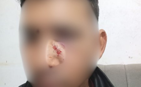 Homem é atingido por bala perdida enquanto dormia em Campo Grande