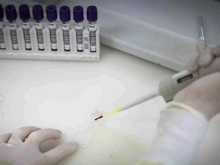 Exames descartam ebola em imigrante da República Democrática do Congo